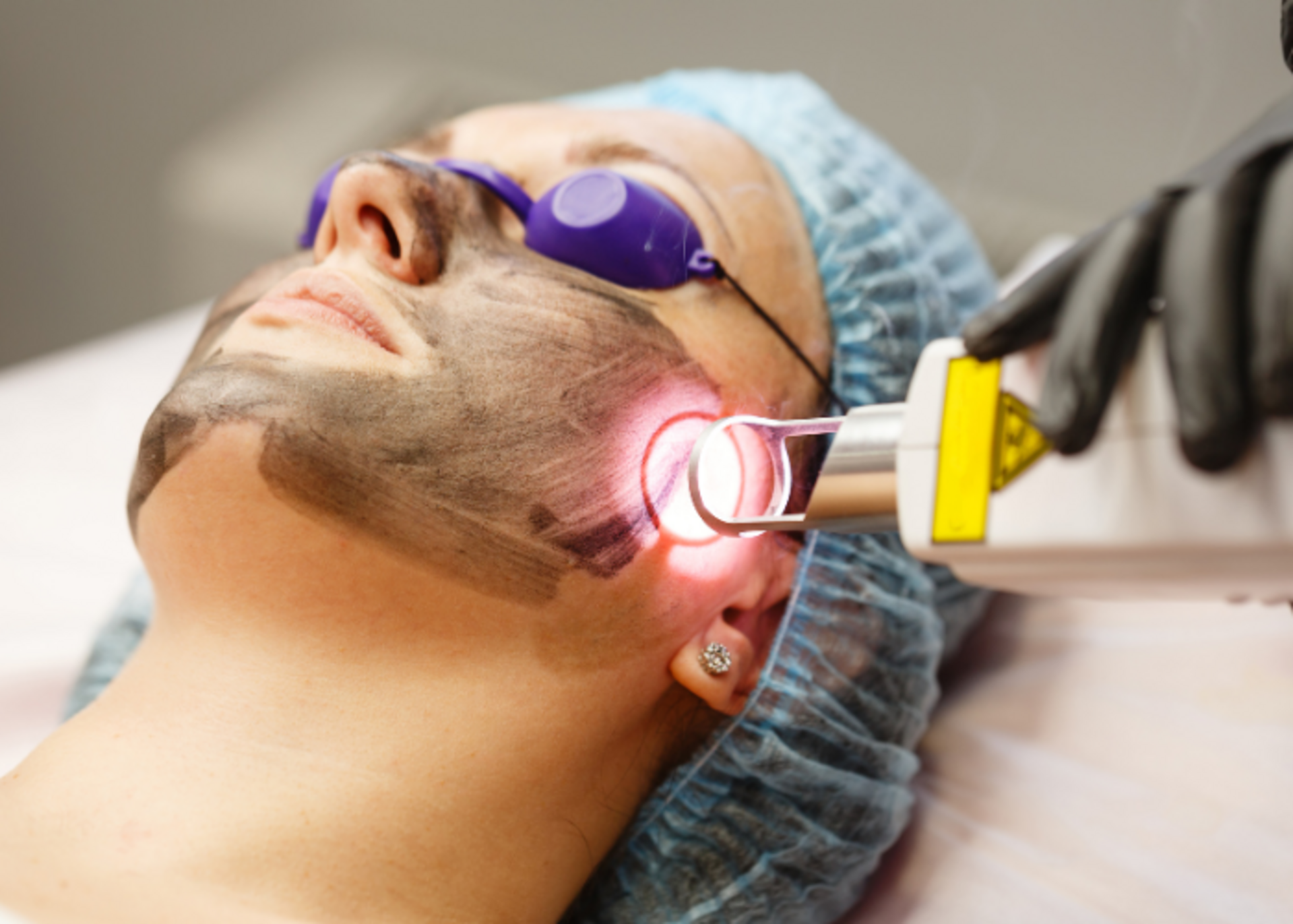 Laser skin therapy