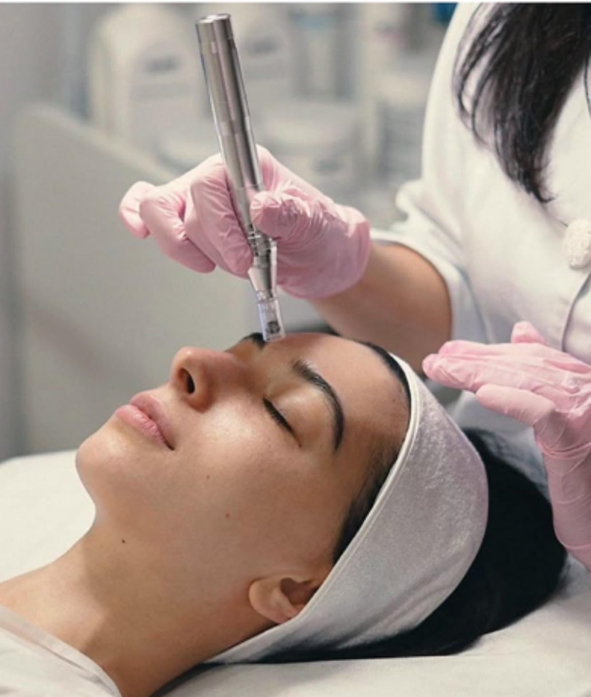 Micro-needling
