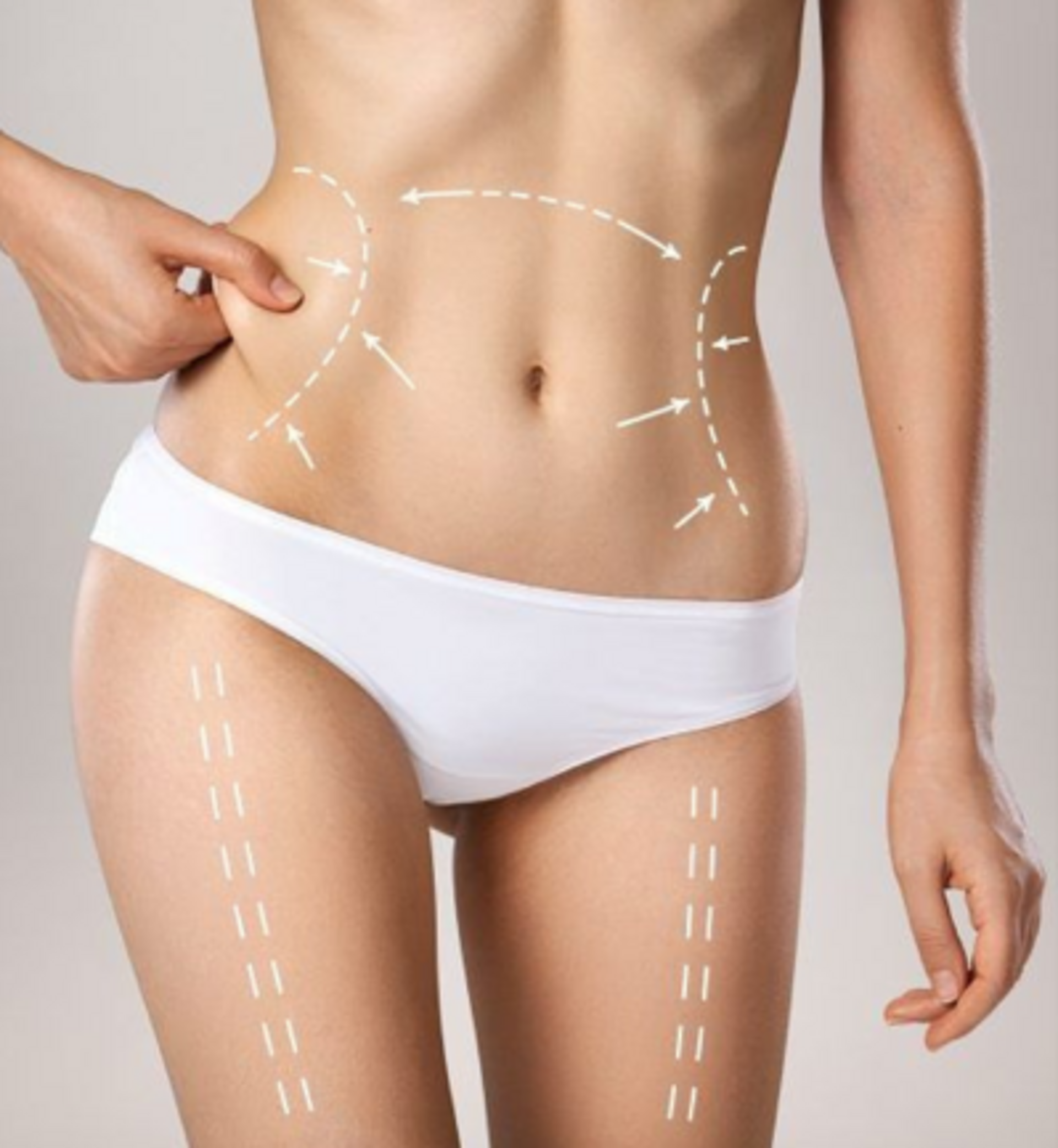 Body Contouring